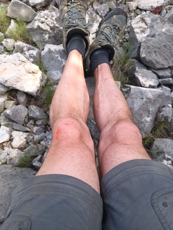 A force de grimper sur les genoux