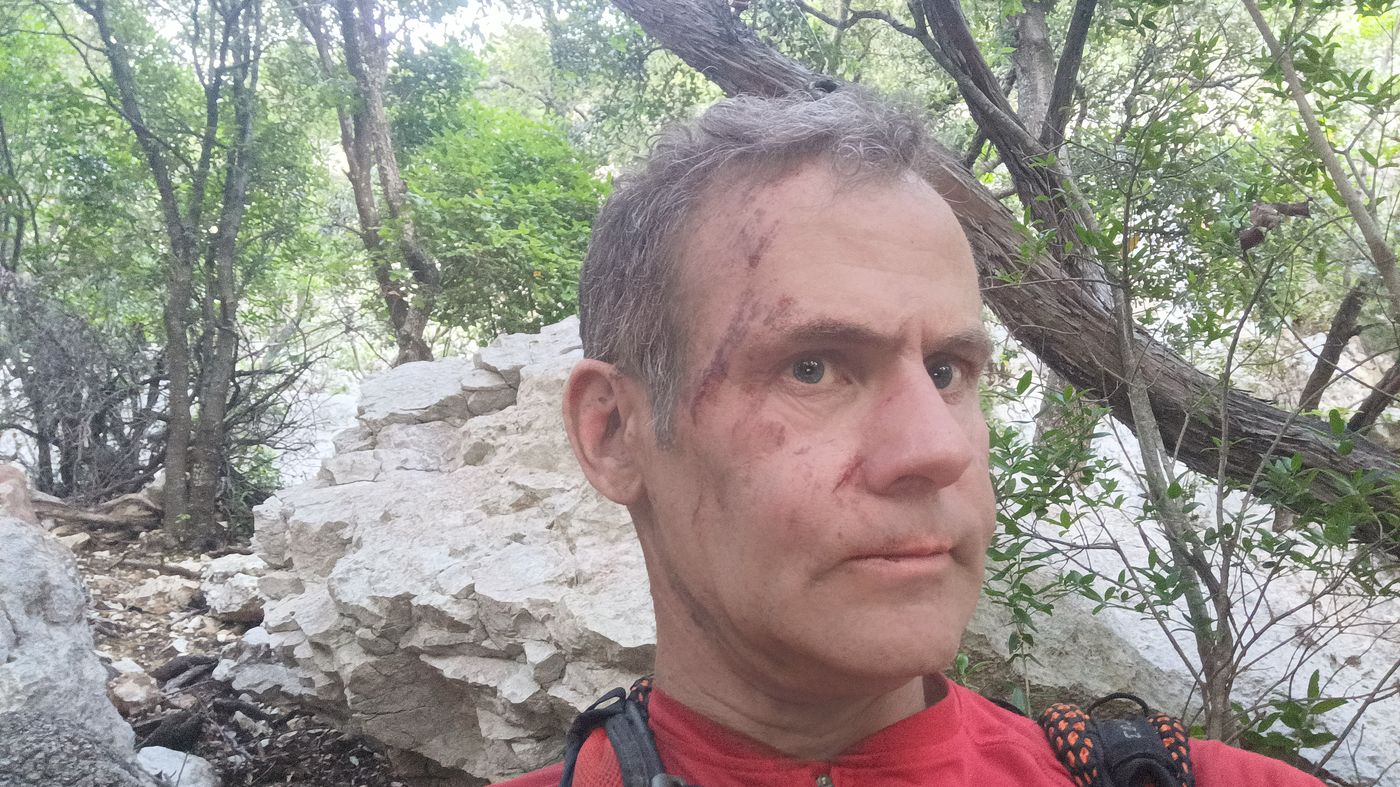 égratignure et poussière au visage