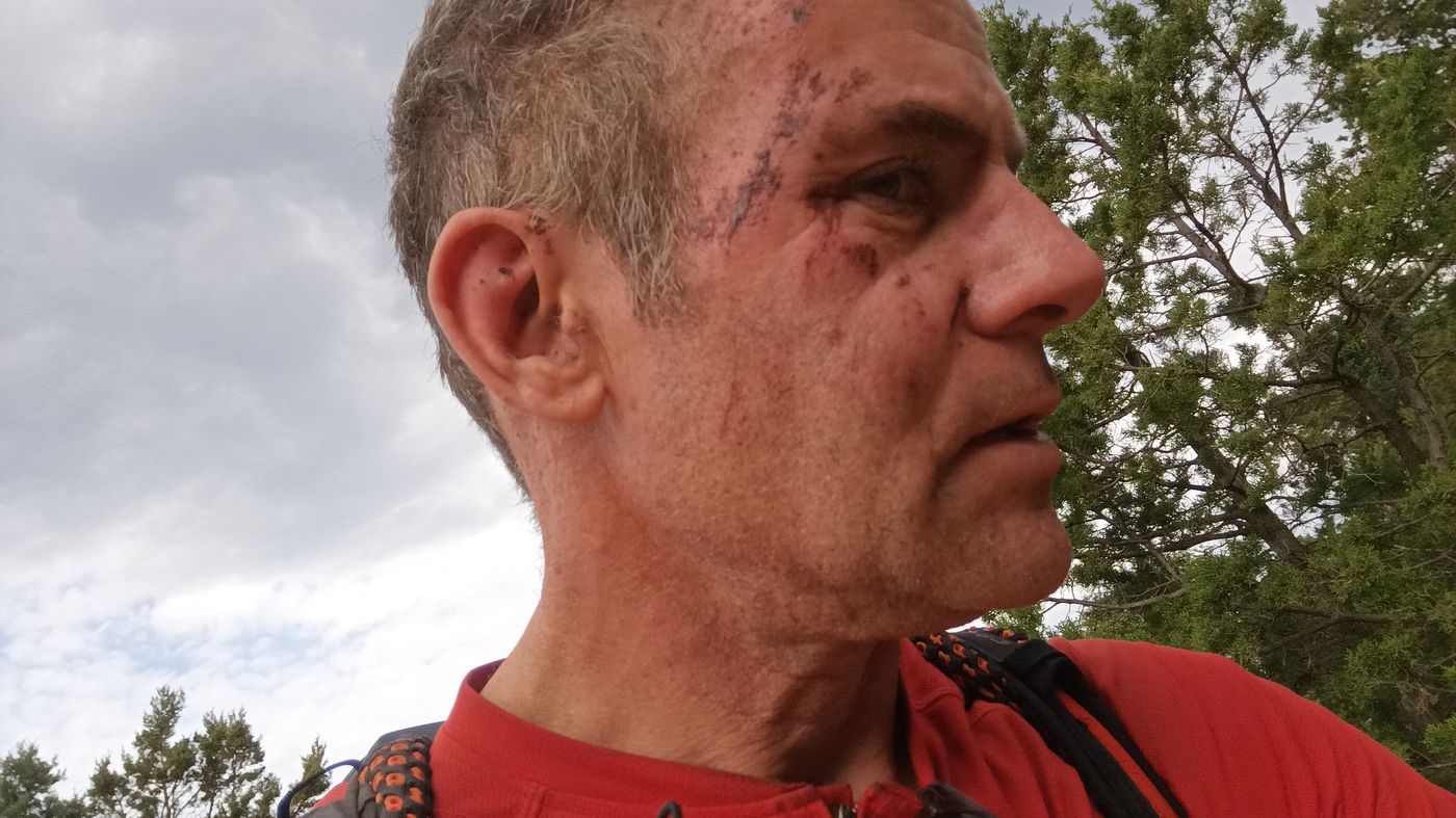 Bon, après une journée à séché, les croutes grattent un peu le visage !